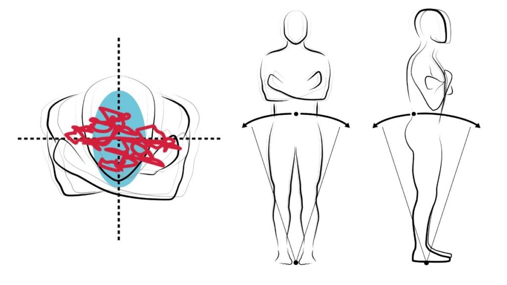 postural sway after knee replacement